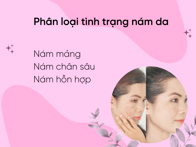 Phân loại các tình trạng nám da mà bạn chưa biết